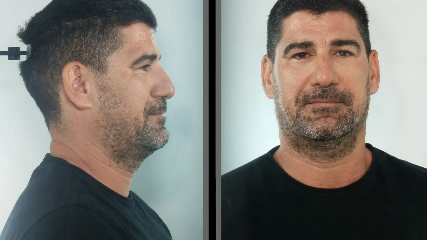 Στέλεχος της ΝΔ και πρώην υποψήφιος σε «γαλάζιο» ψηφοδέλτιο ο προφυλακισμένος γυμναστής της Κεφαλονιάς – Διώκεται για βιασμό ανηλίκων