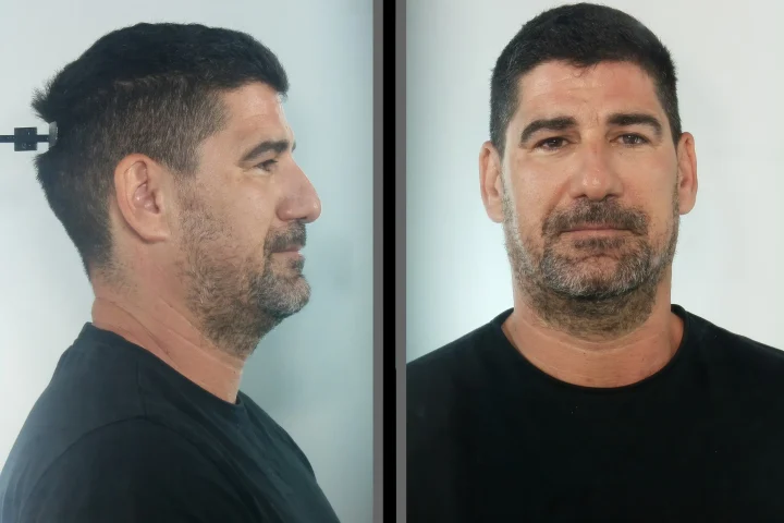 Στέλεχος της ΝΔ και πρώην υποψήφιος σε «γαλάζιο» ψηφοδέλτιο ο προφυλακισμένος γυμναστής της Κεφαλονιάς – Διώκεται για βιασμό ανηλίκων