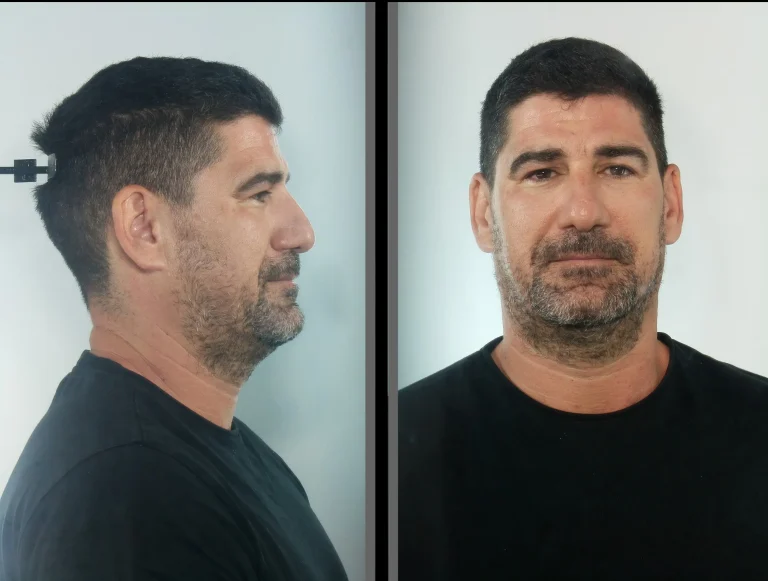 Στέλεχος της ΝΔ και πρώην υποψήφιος σε «γαλάζιο» ψηφοδέλτιο ο προφυλακισμένος γυμναστής της Κεφαλονιάς – Διώκεται για βιασμό ανηλίκων